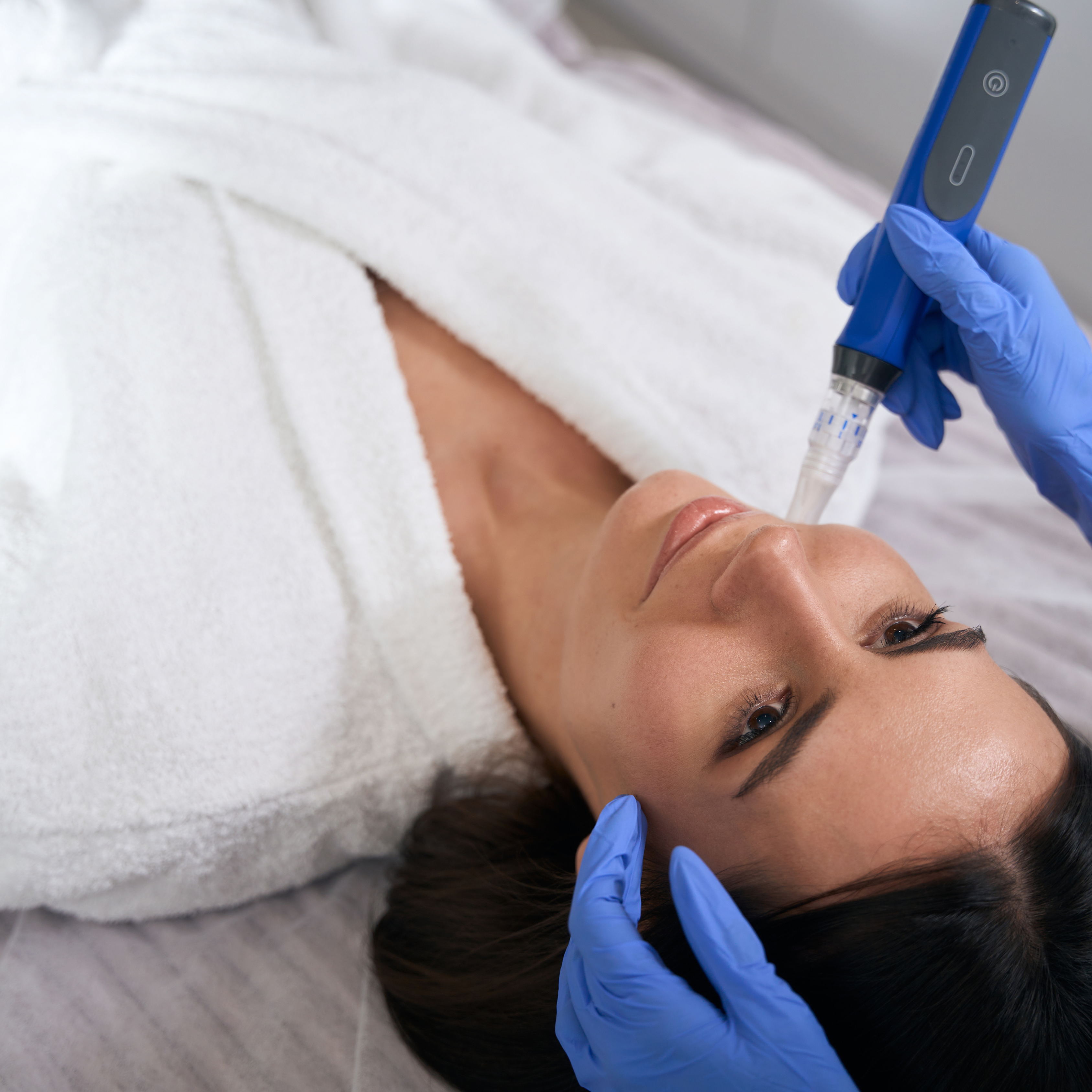 The Ultimate Guide to Microneedling: How Tiny Needles Can Transform Your Skin